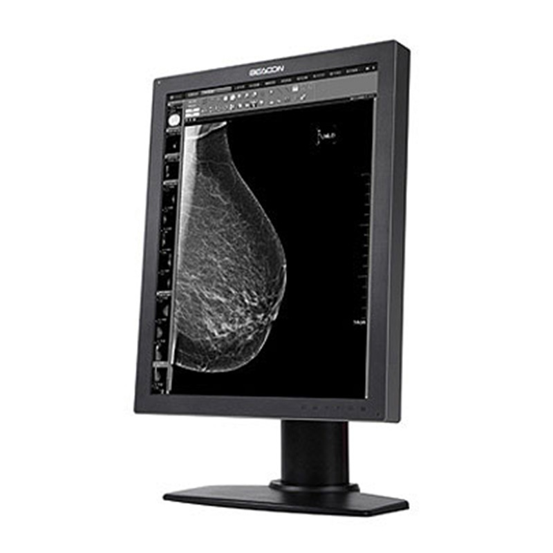 Монитор диагностический G52S Plus черно-белый